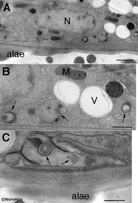 DEpiFIG 2: Dauer seam cell showing enhanced autophagy