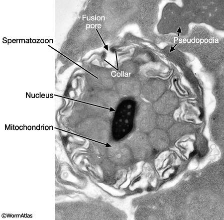 MaleReproFIG 24 Ultrastructure of spermatozoon