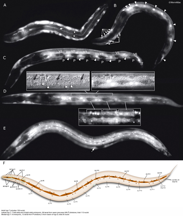 HypFIG 8A-F Hypodermal development during larval stages