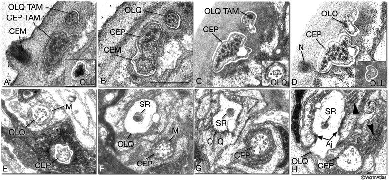 NeuroFIG 31 CEP, CEM, and OL cilia ultrastructure, all transverse sections