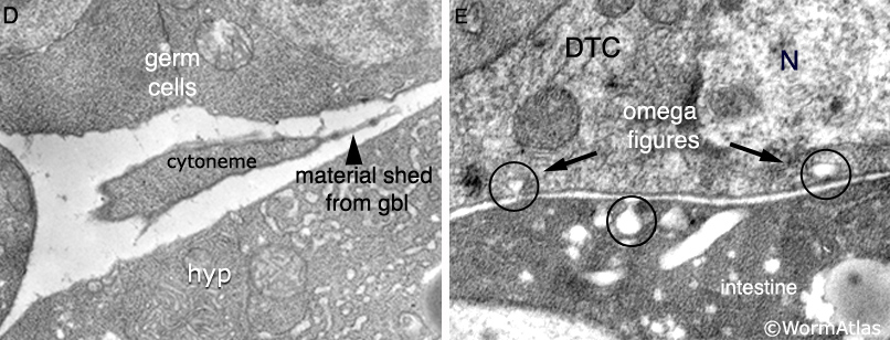 SomaticFIG 2D&E Transmission electron micrograph images of the DTC