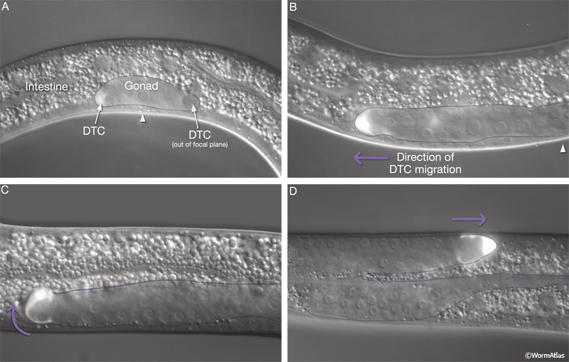 SomaticFIG 3 The DTC regulates gonad elongations during development