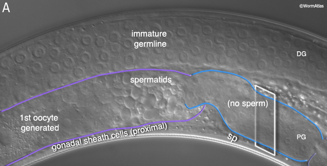SomaticFIG 9 Cell junctions of the spermatheca