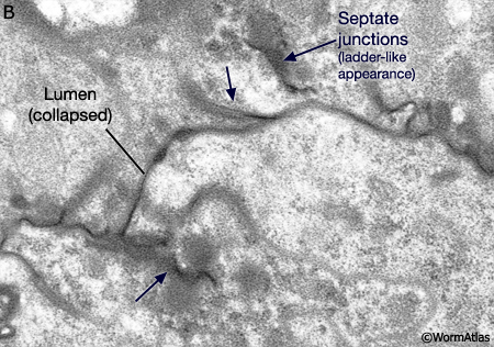 MaleReproFIG 16B Septate junction in the vas deferens